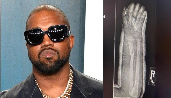 Kanye West zdieľa zábery toho, čo vyzerá ako zlomená ruka syna Sainta