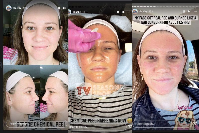 OutDaughtered: ¡El procedimiento cosmético de Danielle Busby salió mal! ¿Cara arruinada?