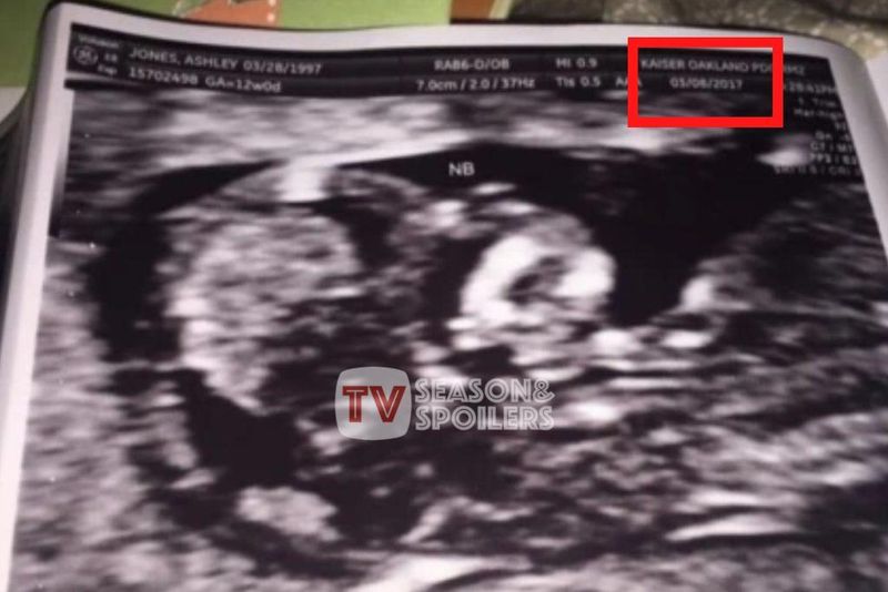 Mare adolescent: Ashley Jones embarassada? Comparteix les imatges de Sonogram!