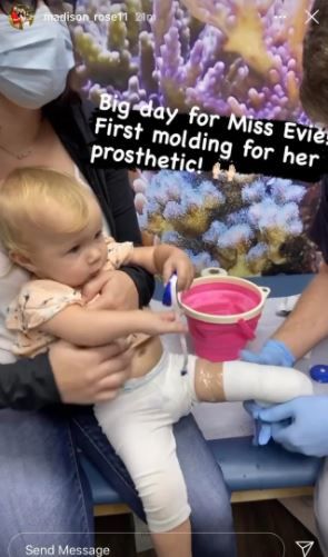 Bintang 'Sister Wives' Anak perempuan Maddie Brown Evie Mendapat Anggota Tiruan melalui Pembedahan, Peminat Mempersoalkan Keputusan