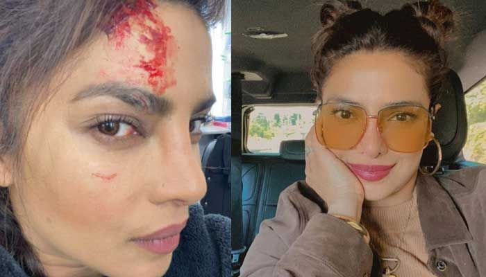 Priyanka Chopra se blesse lors du tournage de 'Citadelle'
